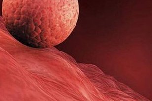 2026年马来西亚三代试管婴儿费用全解析及预算指南