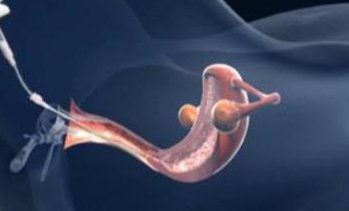 更新2026乌鲁木齐试管助孕医院排名，解读试管助孕生孩子的条件