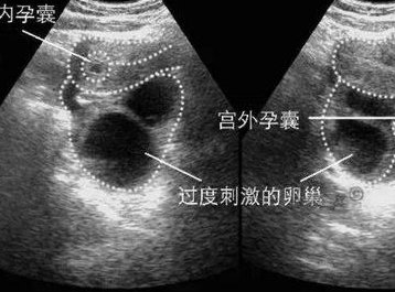 江苏省试管助孕公司-江苏徐州辅助生殖助孕-徐州市正规助孕生育机构